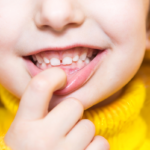 Dlaczego wady zgryzu mogą wpływać na ogólny rozwój dziecka?